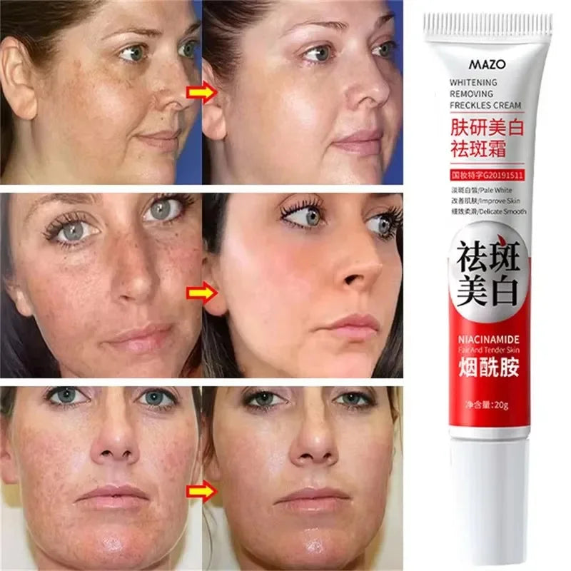 Crema blanqueadora potente que elimina manchas