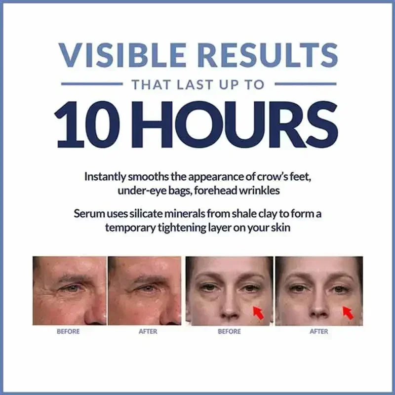 Crema instantánea para ojos, antiedad, ojeras, bolsas, hinchazón