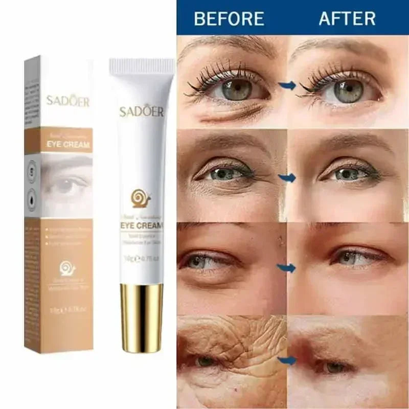 Crema instantánea para ojos, antiedad, ojeras, bolsas, hinchazón