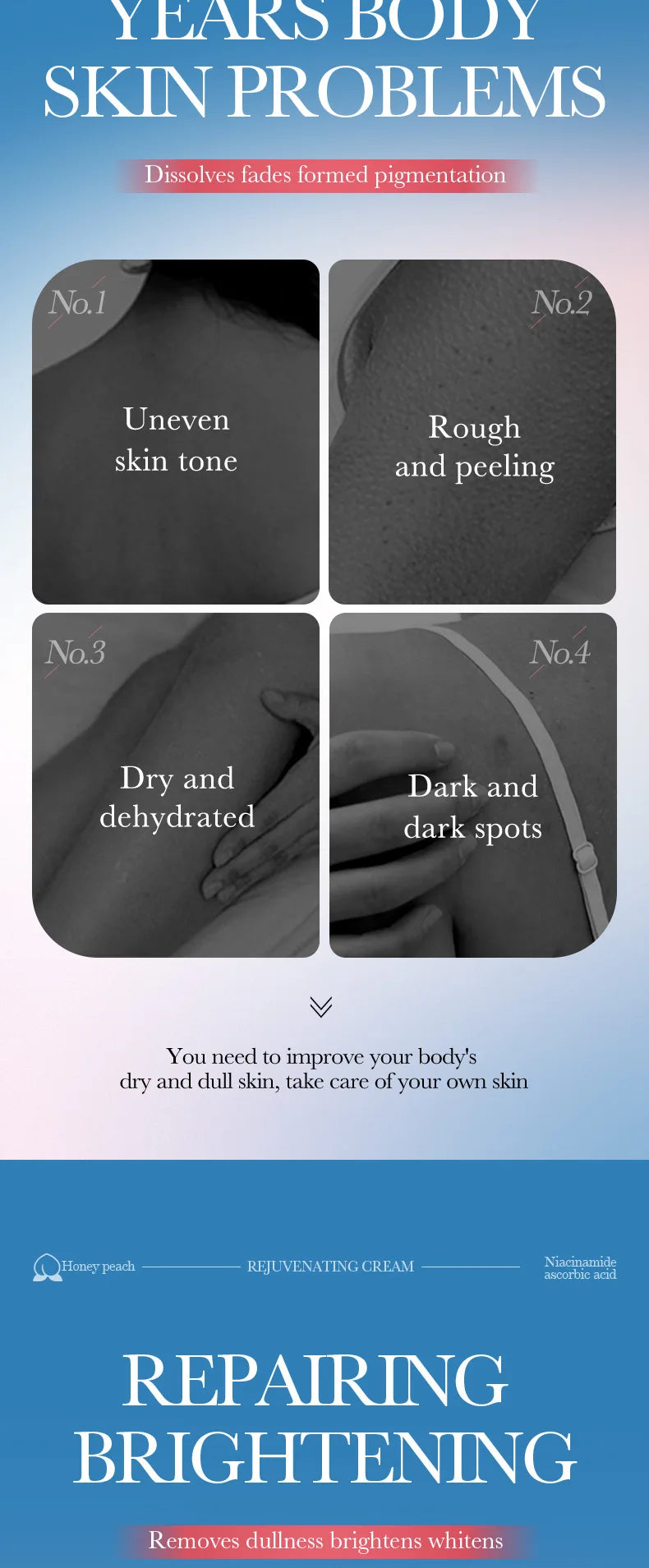 Whitening Cream Private Parts Underarm Butt Knee Whiten Inner Thigh Intimate Parts Dark Remove Melanin Woman Brighten Skin Care