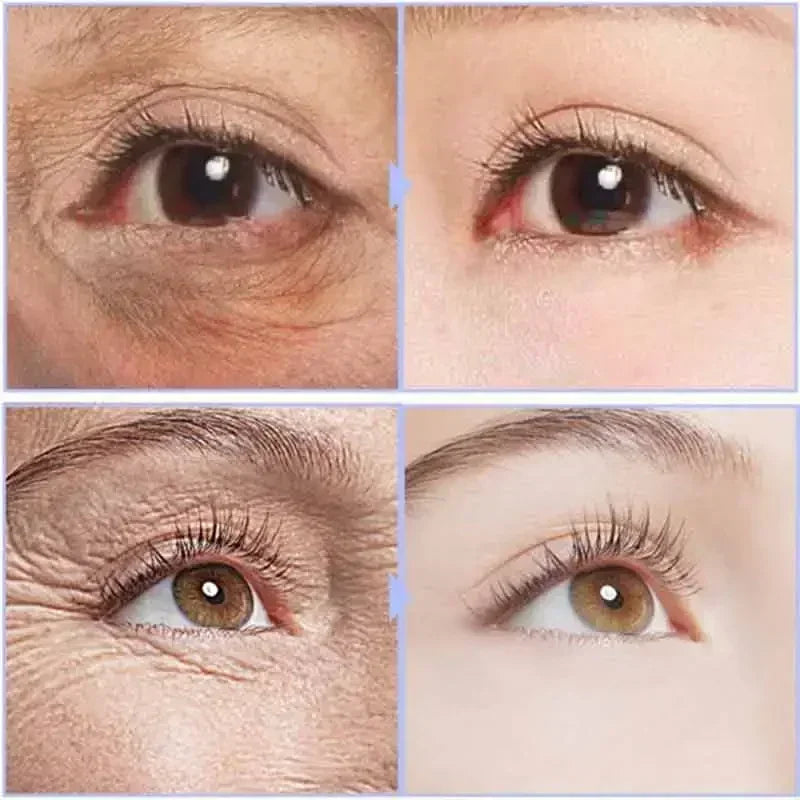 Crema instantánea para ojos, antiedad, ojeras, bolsas, hinchazón