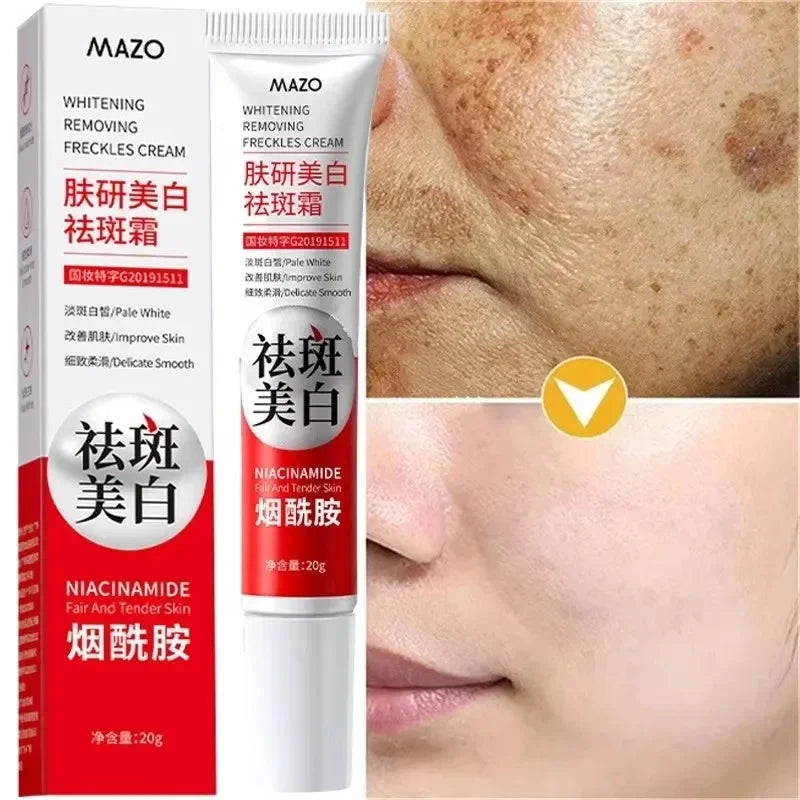 Crema blanqueadora potente que elimina manchas
