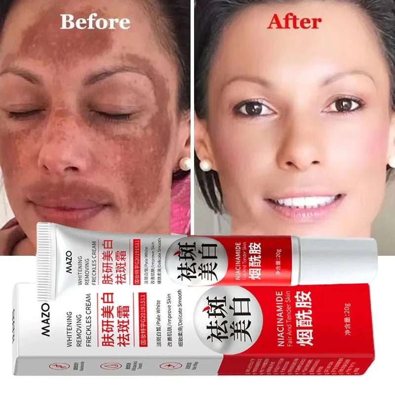 Crema blanqueadora potente que elimina manchas