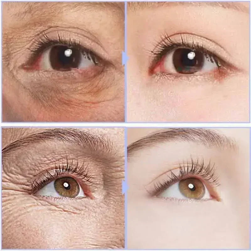 Crema instantánea para ojos, antiedad, ojeras, bolsas, hinchazón