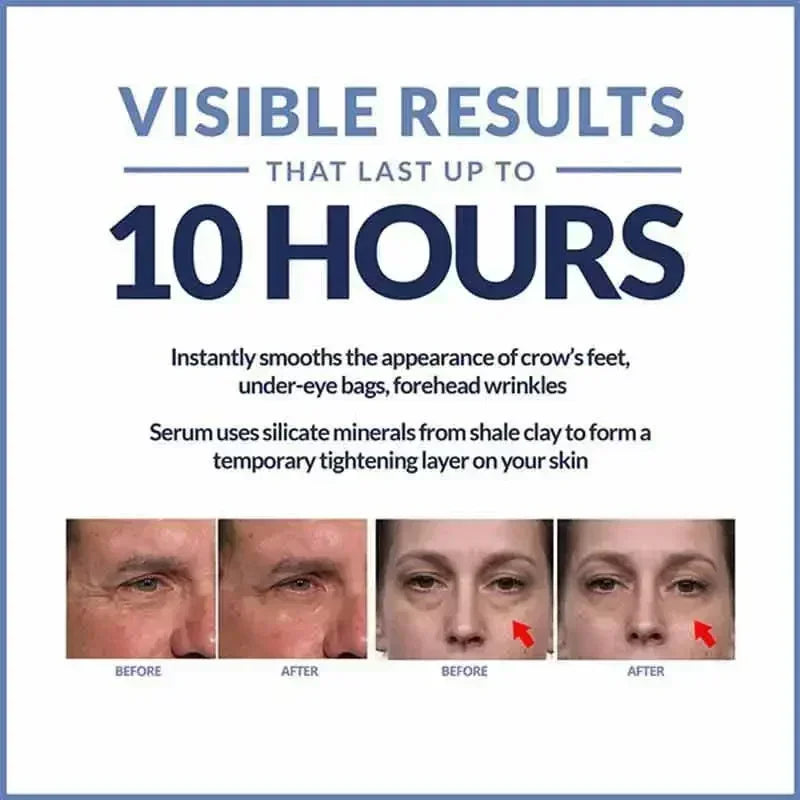 Crema instantánea para ojos, antiedad, ojeras, bolsas, hinchazón