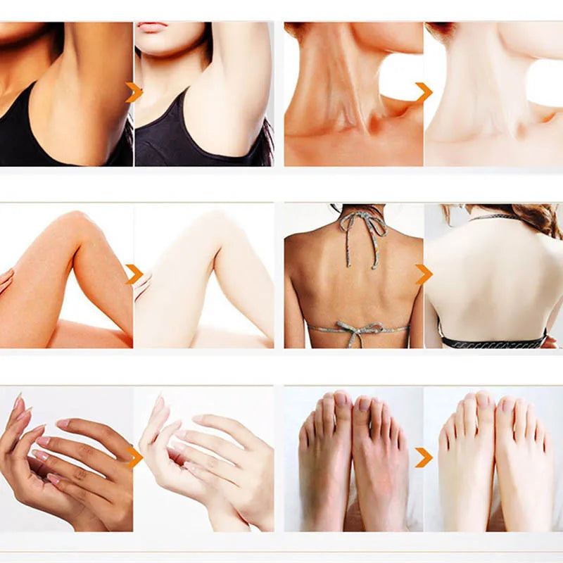 Whitening Cream Private Parts Underarm Butt Knee Whiten Inner Thigh Intimate Parts Dark Remove Melanin Woman Brighten Skin Care